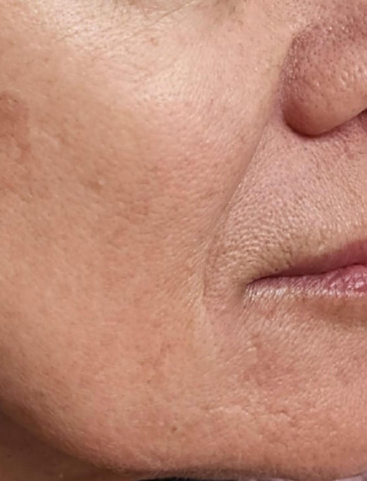 אנטי אייג'ינג עדין