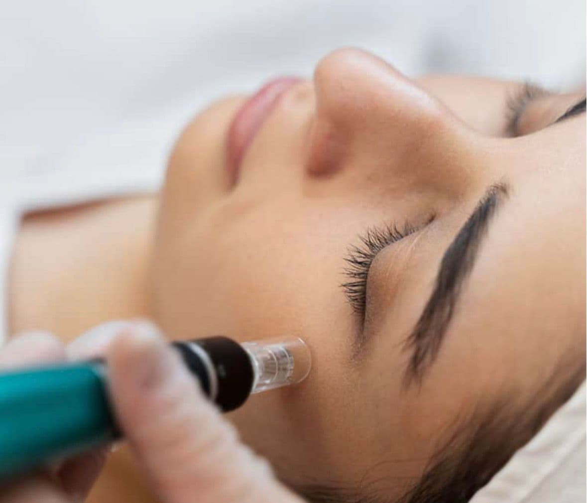 מיקרונידלינג מבוקר