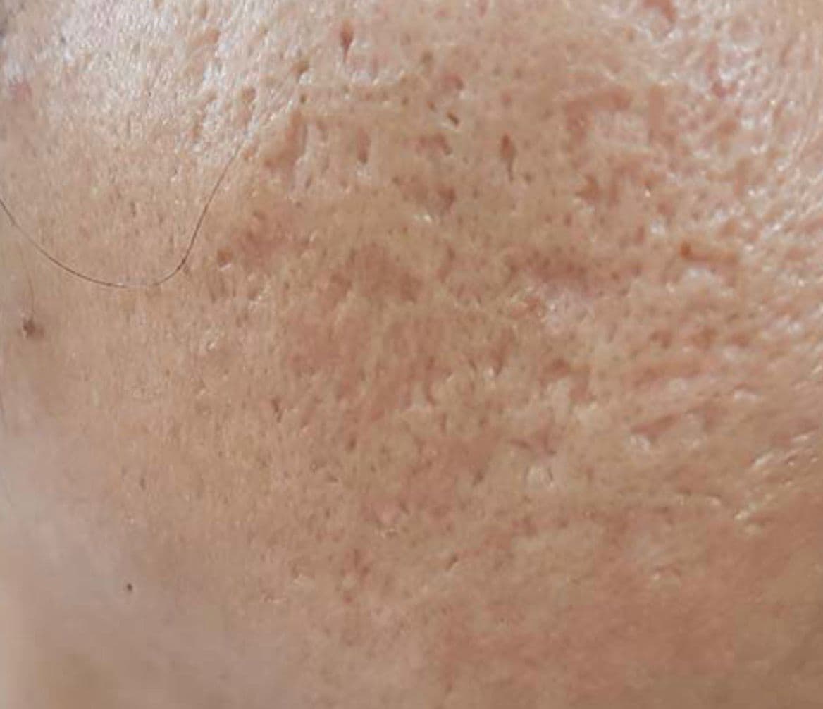 צלקות וכתמים